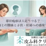 帯状疱疹は人にうつる？｜水疱瘡（水痘）との関係と子供・妊婦への感染リスク