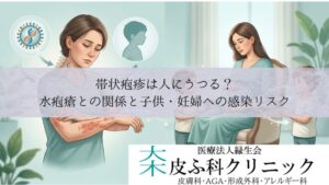 帯状疱疹は人にうつる？｜水疱瘡（水痘）との関係と子供・妊婦への感染リスク