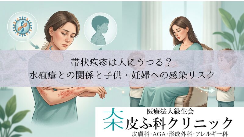 帯状疱疹は人にうつる？｜水疱瘡（水痘）との関係と子供・妊婦への感染リスク