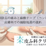 水いぼ除去の痛みと麻酔テープ（ペンレス）｜皮膚科での摘除処置の流れ