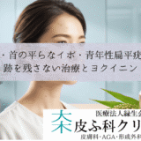 顔・首の平らなイボ・青年性扁平疣贅｜跡を残さない治療とヨクイニン