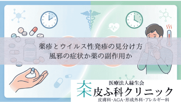 薬疹とウイルス性発疹（中毒疹）の見分け方｜風邪の症状か薬の副作用か
