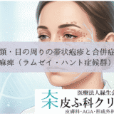 顔・目の周りの帯状疱疹と合併症｜顔面神経麻痺（ラムゼイ・ハント症候群）のリスク