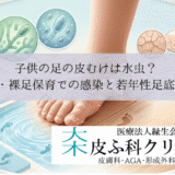 子供の足の皮むけは水虫？｜プール・裸足保育での感染と若年性足底皮膚症