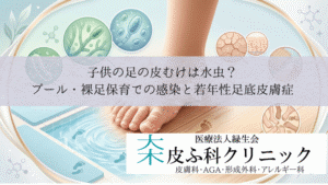 子供の足の皮むけは水虫？｜プール・裸足保育での感染と若年性足底皮膚症