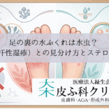 足の裏の水ぶくれは水虫？｜汗疱（異汗性湿疹）との見分け方とステロイド禁忌
