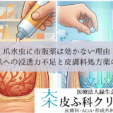 爪水虫に市販薬は効かない理由｜硬い爪への浸透力不足と皮膚科処方薬の強み