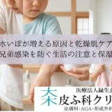 水いぼが増える原因と乾燥肌ケア｜兄弟感染を防ぐ生活の注意と保湿