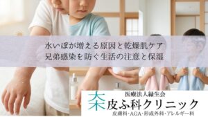 水いぼが増える原因と乾燥肌ケア｜兄弟感染を防ぐ生活の注意と保湿