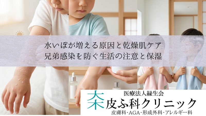 水いぼが増える原因と乾燥肌ケア｜兄弟感染を防ぐ生活の注意と保湿