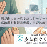 飲み薬が飲めない爪水虫とレーザー治療｜高齢者や肝障害患者の自費診療