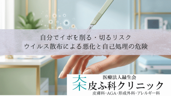 自分でイボを削る・切るリスク｜ウイルス散布による悪化と自己処理の危険