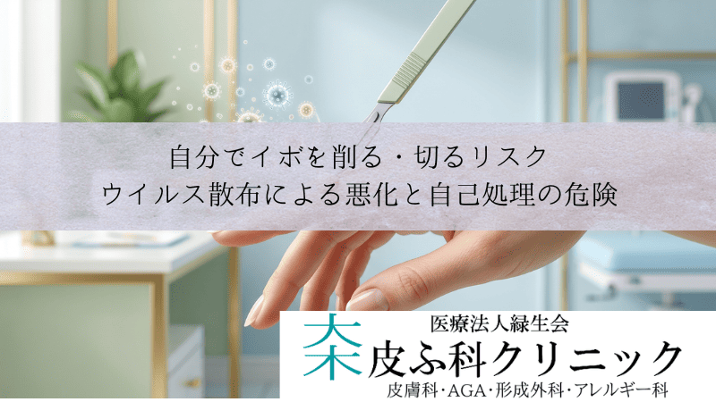 自分でイボを削る・切るリスク｜ウイルス散布による悪化と自己処理の危険