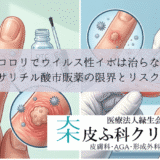 イボコロリでウイルス性イボは治らない？｜サリチル酸市販薬の限界とリスク