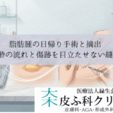 脂肪腫の日帰り手術と摘出｜局所麻酔の流れと傷跡を目立たせない縫合技術