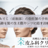 おでこ（前額部）の脂肪腫の手術｜傷跡を髪の生え際やシワに隠す治療
