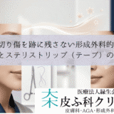 顔の切り傷を跡に残さない形成外科的処置｜縫合とステリストリップ（テープ）の選択