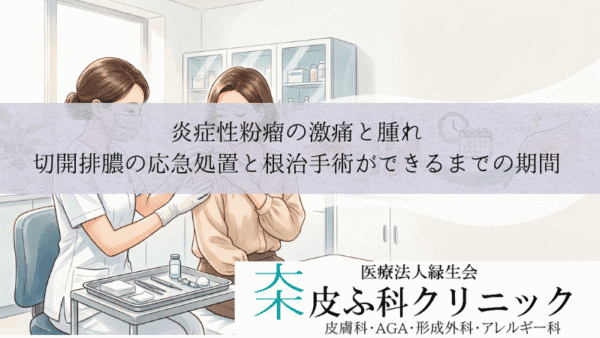 炎症性粉瘤の激痛と腫れ｜切開排膿の応急処置と根治手術ができるまでの期間
