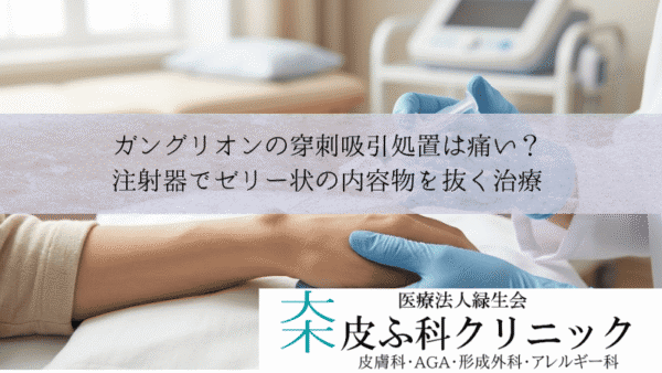 ガングリオンの穿刺吸引処置は痛い？｜注射器でゼリー状の内容物を抜く治療
