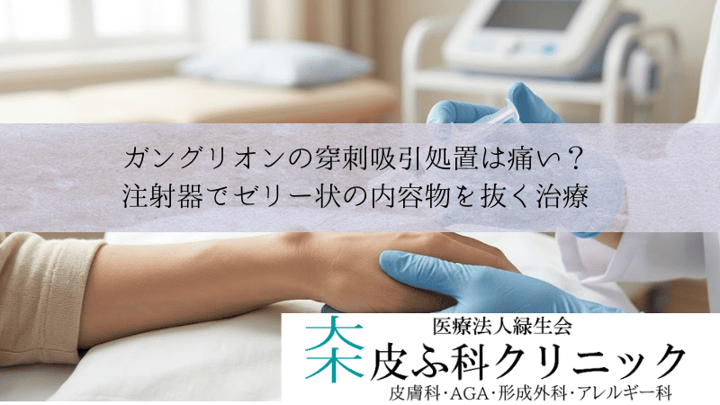 ガングリオンの穿刺吸引処置は痛い？｜注射器でゼリー状の内容物を抜く治療