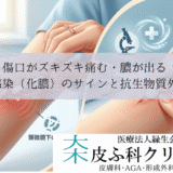 傷口がズキズキ痛む・膿が出る｜細菌感染（化膿）のサインと抗生物質外用薬