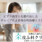 ピアス肉芽と化膿の治し方｜シリコンチューブによる保存的治療とステロイド