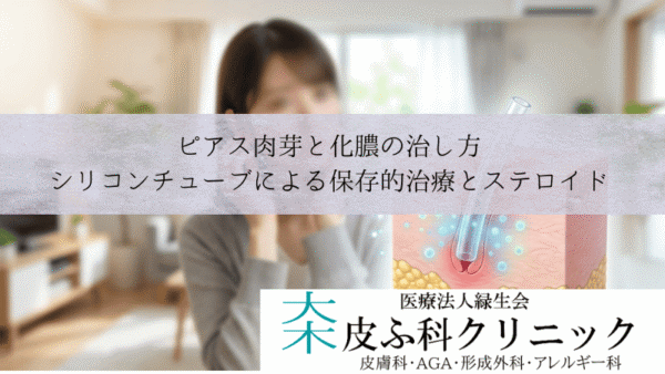 ピアス肉芽と化膿の治し方｜シリコンチューブによる保存的治療とステロイド