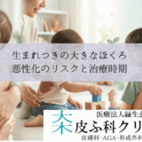 生まれつきの大きなほくろ・先天性巨大色素性母斑｜悪性化のリスクと治療時期