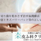 切り傷を乾かさず治す湿潤療法｜消毒液の害とキズパワーパッド等の正しい使い方