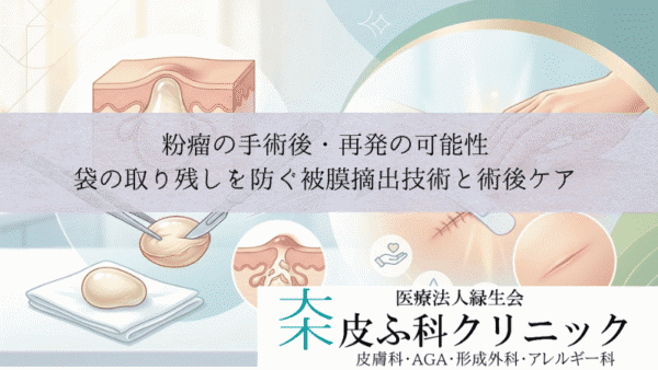 粉瘤の手術後・再発の可能性｜袋の取り残しを防ぐ被膜摘出技術と術後ケア