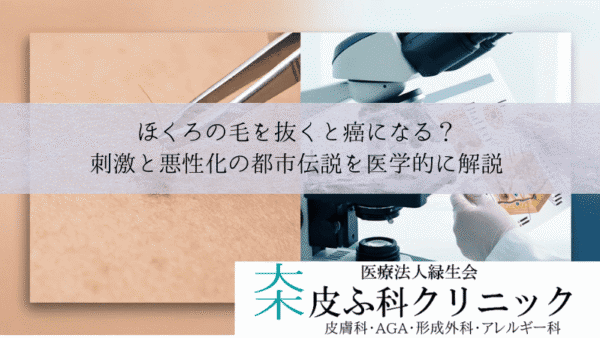 ほくろの毛を抜くと癌になる？｜刺激と悪性化の都市伝説を医学的に解説
