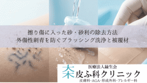擦り傷に入った砂・砂利の除去方法｜外傷性刺青を防ぐブラッシング洗浄と被覆材