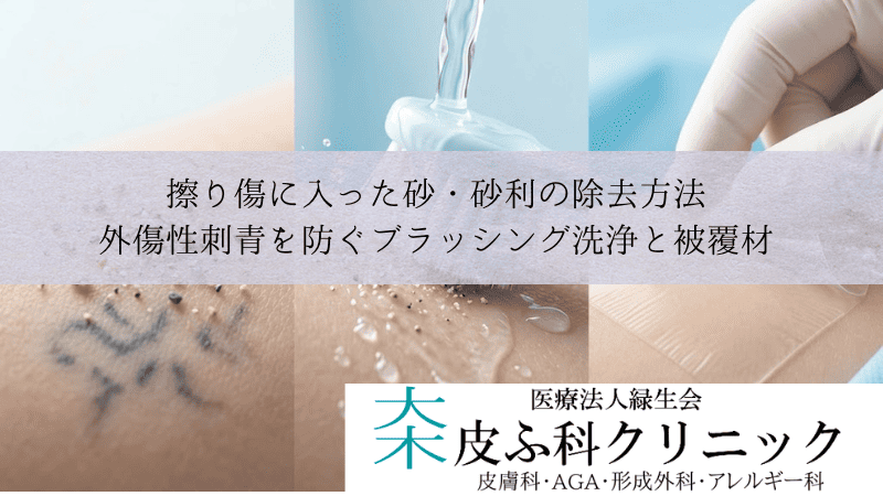 擦り傷に入った砂・砂利の除去方法｜外傷性刺青を防ぐブラッシング洗浄と被覆材