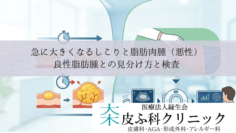 急に大きくなるしこりと脂肪肉腫（悪性）｜良性脂肪腫との見分け方と検査