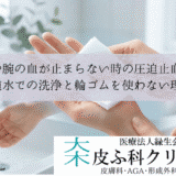 指や腕の血が止まらない時の圧迫止血法｜水道水での洗浄と輪ゴムを使わない理由