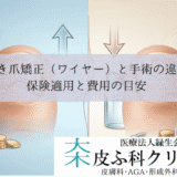 巻き爪矯正（ワイヤー）と手術（フェノール法）の違い｜保険適用と費用の目安