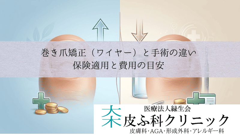 巻き爪矯正（ワイヤー）と手術（フェノール法）の違い｜保険適用と費用の目安