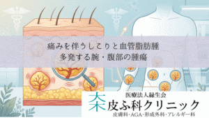 痛みを伴うしこりと血管脂肪腫（アンギオリポーマ）｜多発する腕・腹部の腫瘍