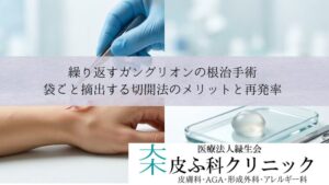 繰り返すガングリオンの根治手術|袋ごと摘出する切開法のメリットと再発率