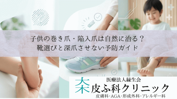 子供の巻き爪・陥入爪は自然に治る？｜靴選びと深爪させない予防ガイド