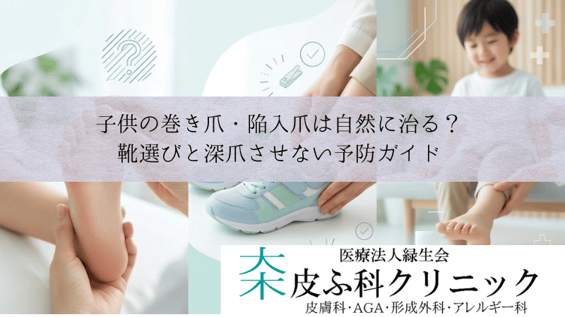 子供の巻き爪・陥入爪は自然に治る?|靴選びと深爪させない予防ガイド