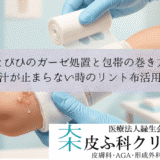 とびひのガーゼ処置と包帯の巻き方｜汁が止まらない時のリント布活用