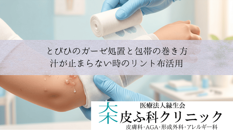 とびひのガーゼ処置と包帯の巻き方｜汁が止まらない時のリント布活用