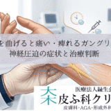 手首を曲げると痛い・痺れるガングリオン｜神経圧迫の症状と治療判断