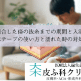縫合した傷の抜糸までの期間と入浴｜防水テープの使い方と濡れた時の対処法
