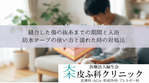 縫合した傷の抜糸までの期間と入浴｜防水テープの使い方と濡れた時の対処法