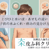 とびひと水いぼ・あせもの違い｜子供の水ぶくれ・痒みの見分け方
