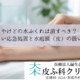 やけどの水ぶくれは潰すべき？｜正しい応急処置と水疱膜（皮）の扱い方