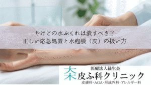 やけどの水ぶくれは潰すべき?|正しい応急処置と水疱膜(皮)の扱い方