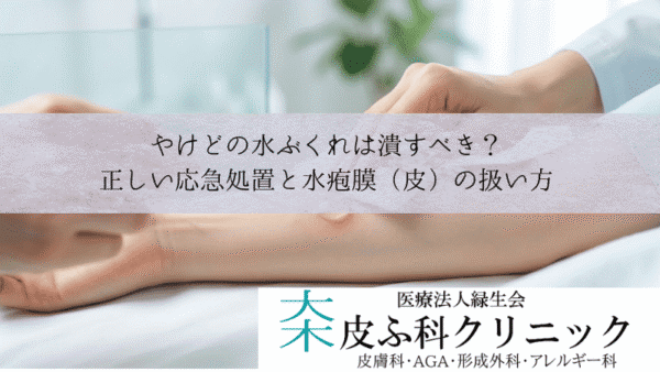 やけどの水ぶくれは潰すべき？｜正しい応急処置と水疱膜（皮）の扱い方